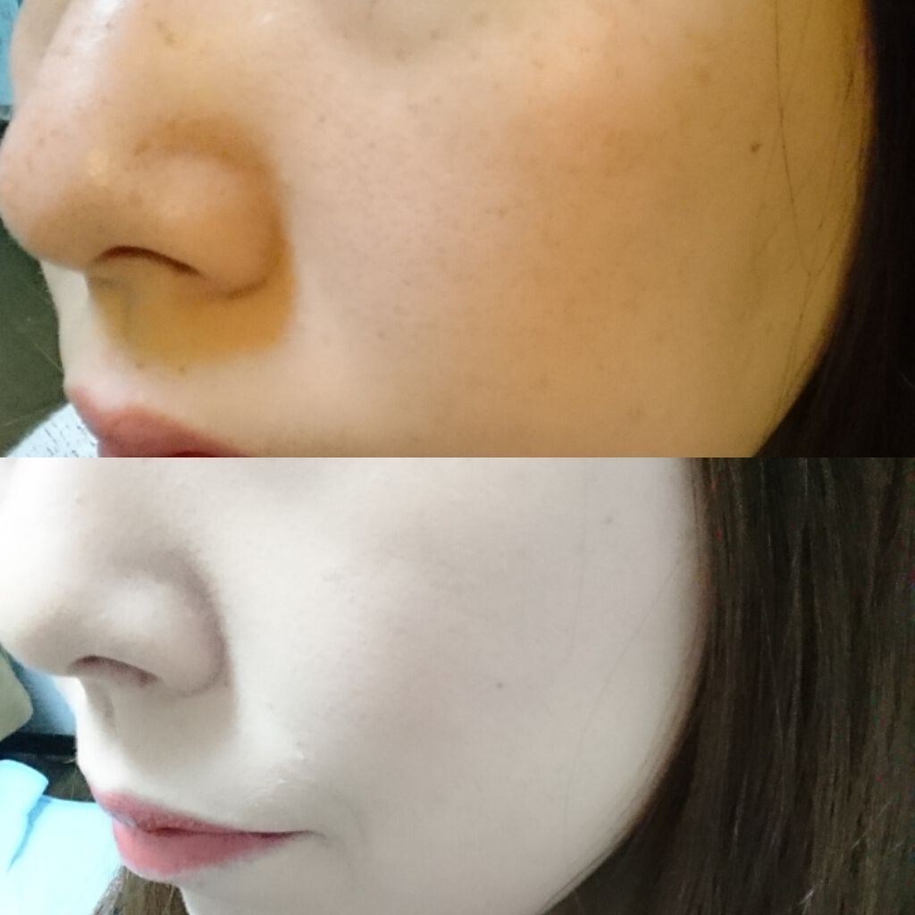 ぱらら✨ on LIPS 「最近そばかすが目立つようになってさ。コンシーラーで隠しても、フ..」(3枚目)