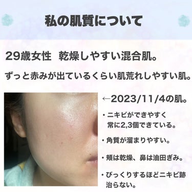 FATUITE ピュリファインディープクレンジングジェルのクチコミ「2023年下半期は肌のキメが整って肌荒れが治ってきて幸せでした！


自分に合ったスキンケアを.....」（2枚目）