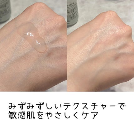 ノスカナイン トラブル セラム/FATION/美容液を使ったクチコミ(2枚目)