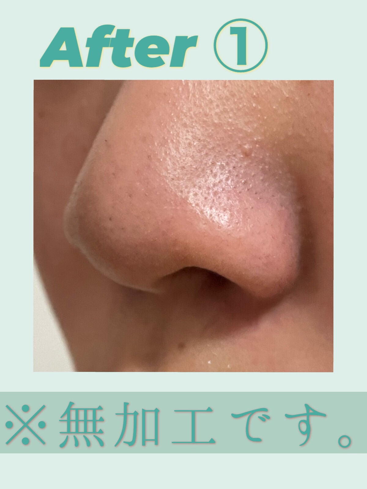 ノーモアブラックヘッド(ノーズピーリング)/One-day's you/スクラブ・ゴマージュを使ったクチコミ(5枚目)