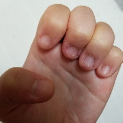 ハンドベール プレミアムリッチネイル/メンソレータム/ネイルオイル・トリートメントを使ったクチコミ(2枚目)