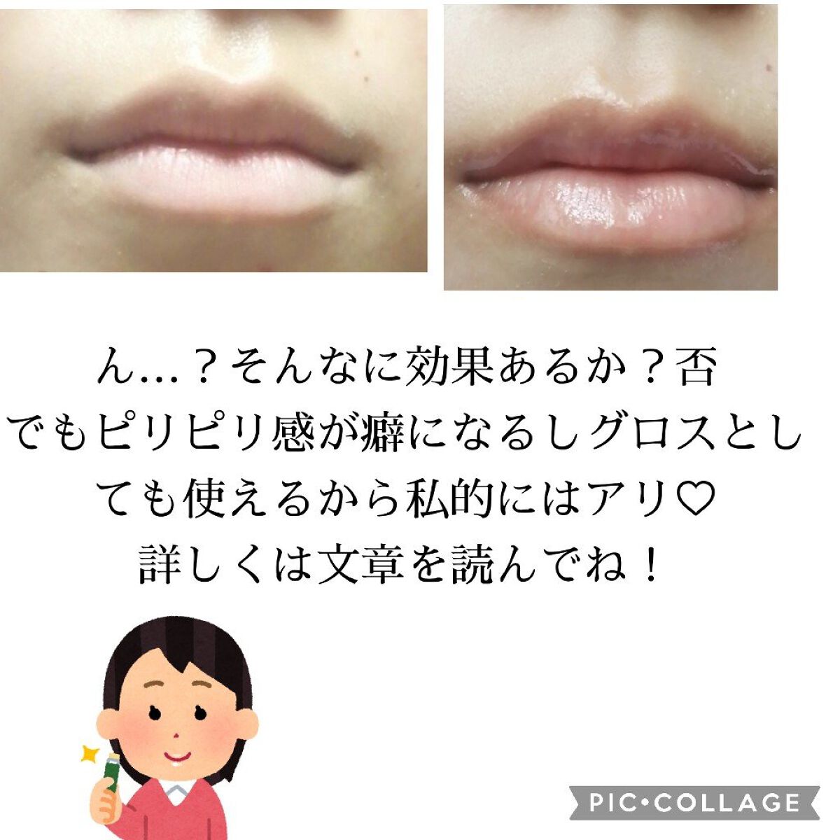 ドトムリッププラスプランパー/keybo/リッププランパーを使ったクチコミ(4枚目)