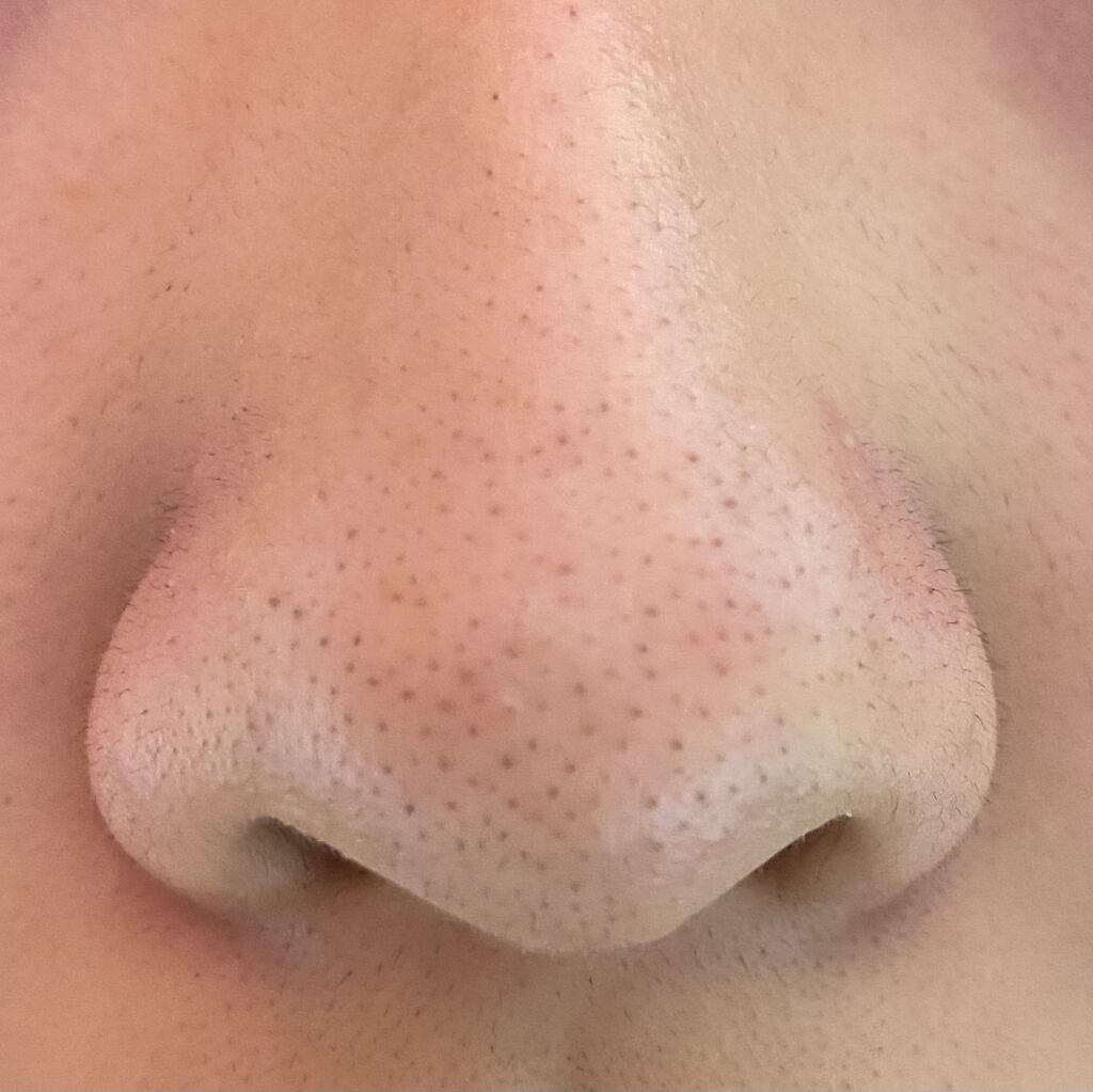 デュオ ザ クレンジングバーム クリア/DUO/クレンジングバームを使ったクチコミ（3枚目）