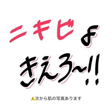 ネオグリーンオブグリーン/クロロフイル/化粧水を使ったクチコミ（1枚目）