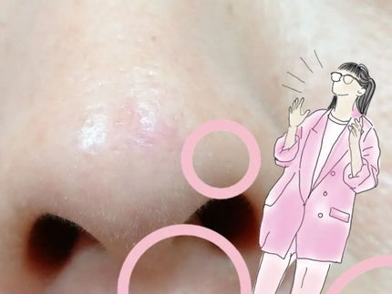 seiko_official on LIPS 「AccalMe(アカルミー)1,化粧水2,セラム気になる#赤ら..」(5枚目)