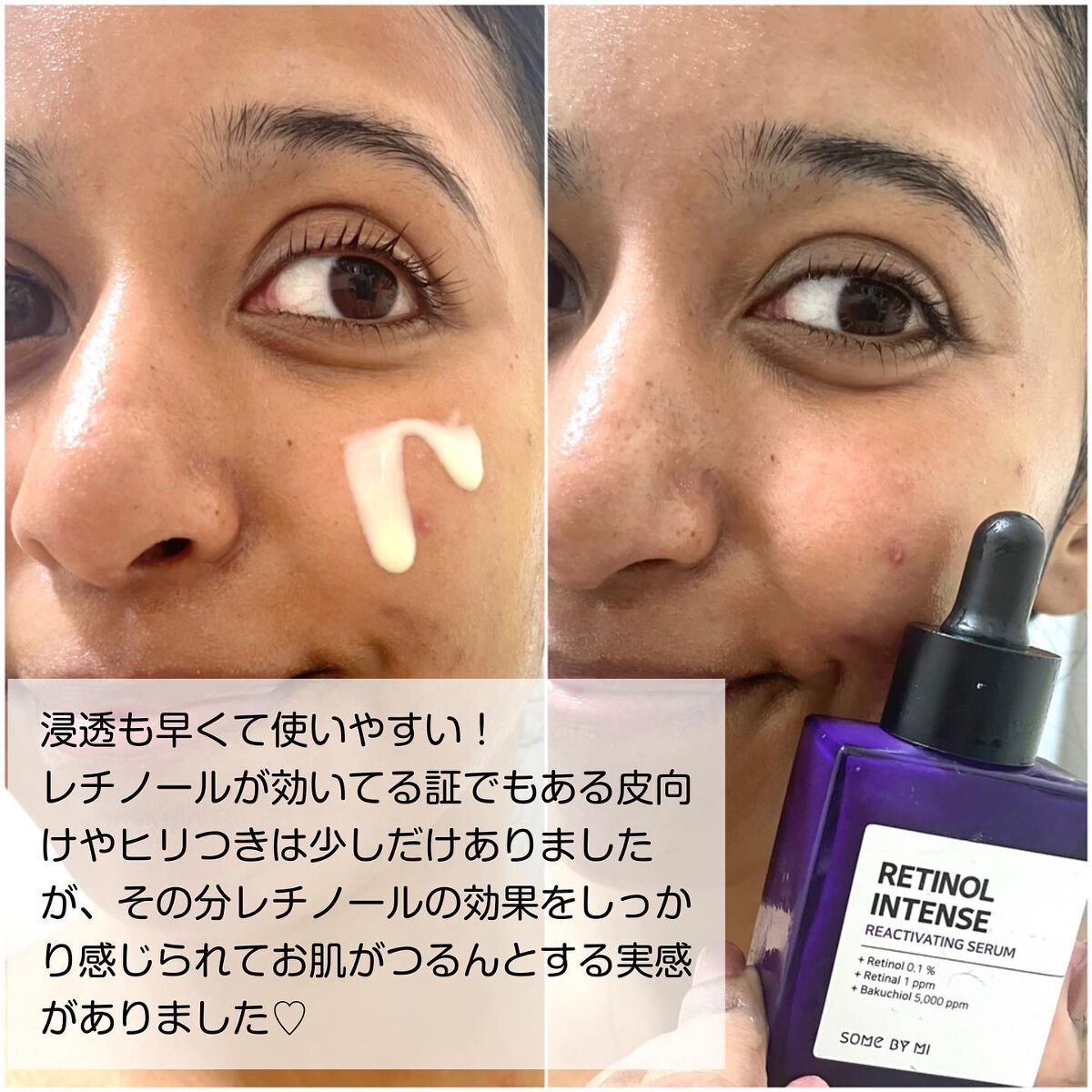 jasmine on LIPS 「\美容マニアは使ってる🌟低刺激レチノールで目元と肌にハリ実感/..」(4枚目)