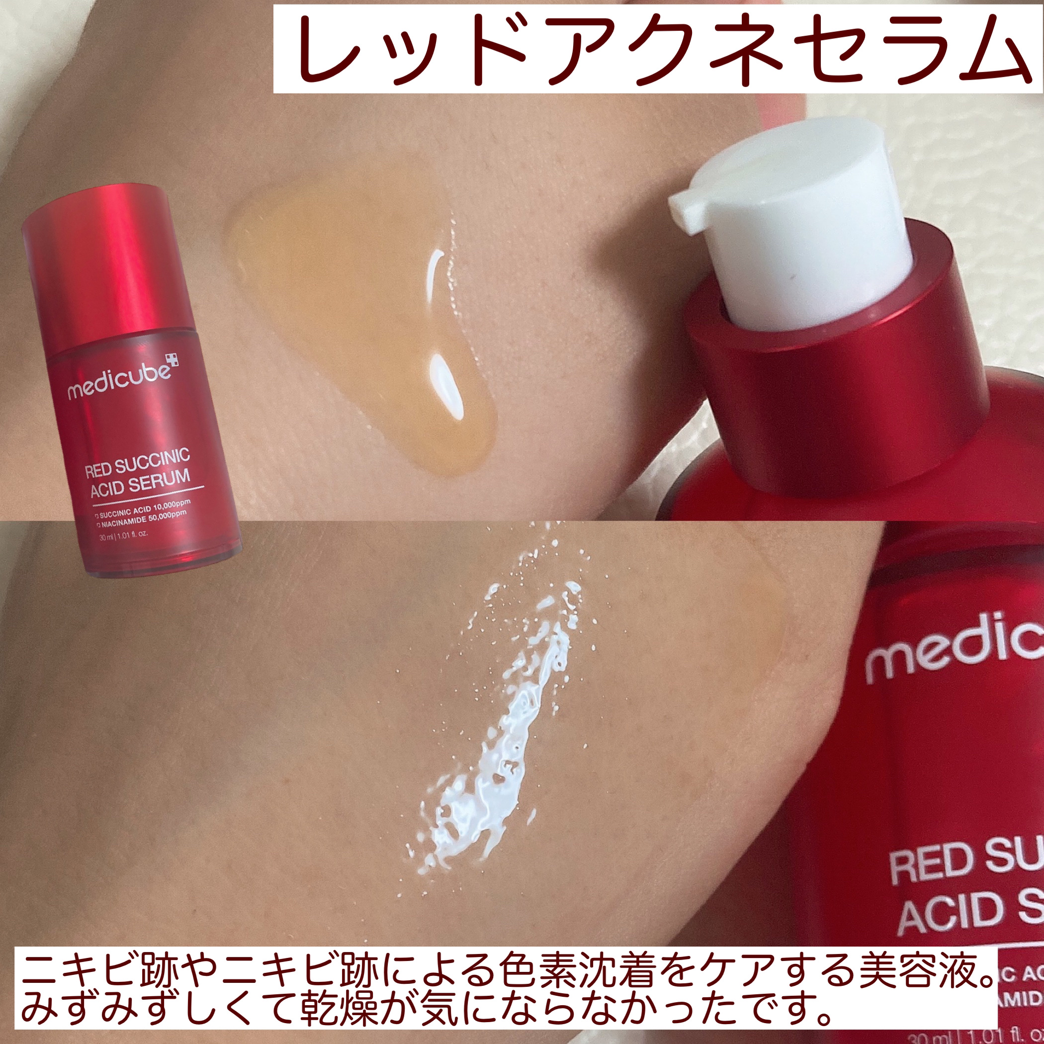 レッドアクネピーリングセラム/MEDICUBE/美容液を使ったクチコミ（2枚目）
