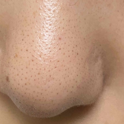 ハトムギ化粧水(ナチュリエ スキンコンディショナー R )/ナチュリエ/化粧水を使ったクチコミ(3枚目)