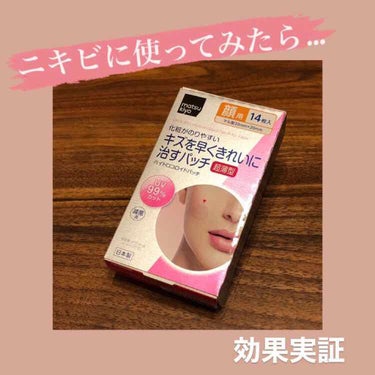 matsukiyo キズを早くきれいに治すパッチのクチコミ「
マツキヨで購入した【キズを早くきれいに治すパッチ】をニキビに使ってみました。
・
2箇所使用.....」（1枚目）