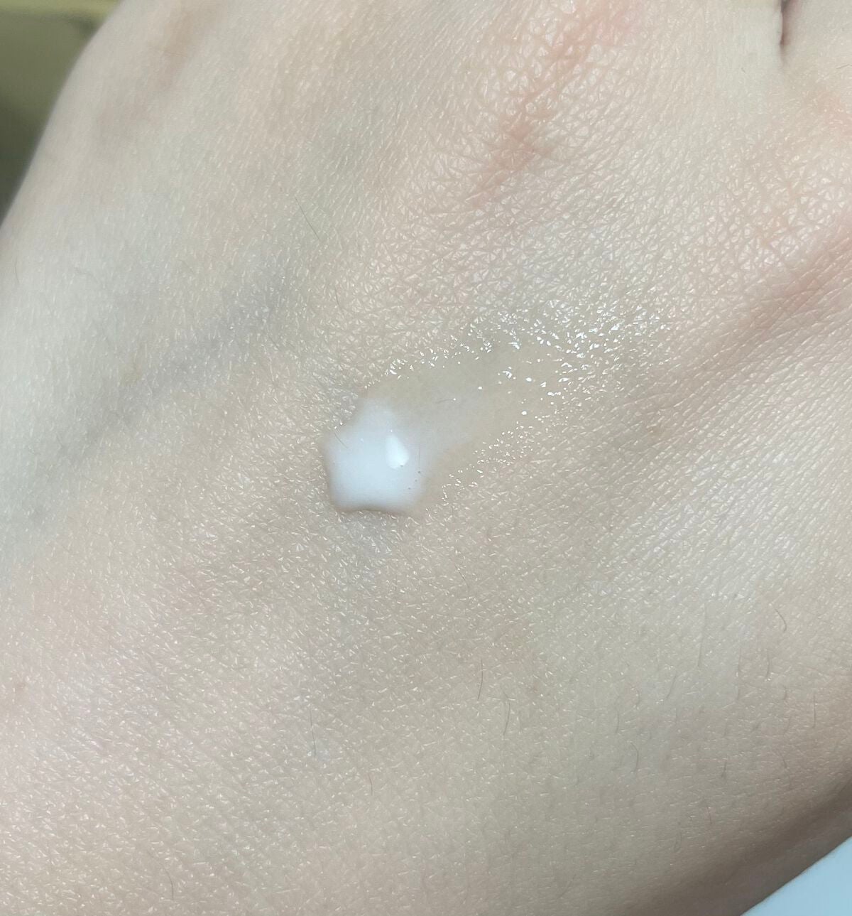 ããðãã©ãã100 on LIPS ããã£ãªãŒã«ã«ããã¥ãŒã«ããŒã¿ã«ã«ã»ã©ã çŸå®¹æ¶²ã®ãµã³ãã«äœ¿ãåã..ãïŒ2æç®ïŒ