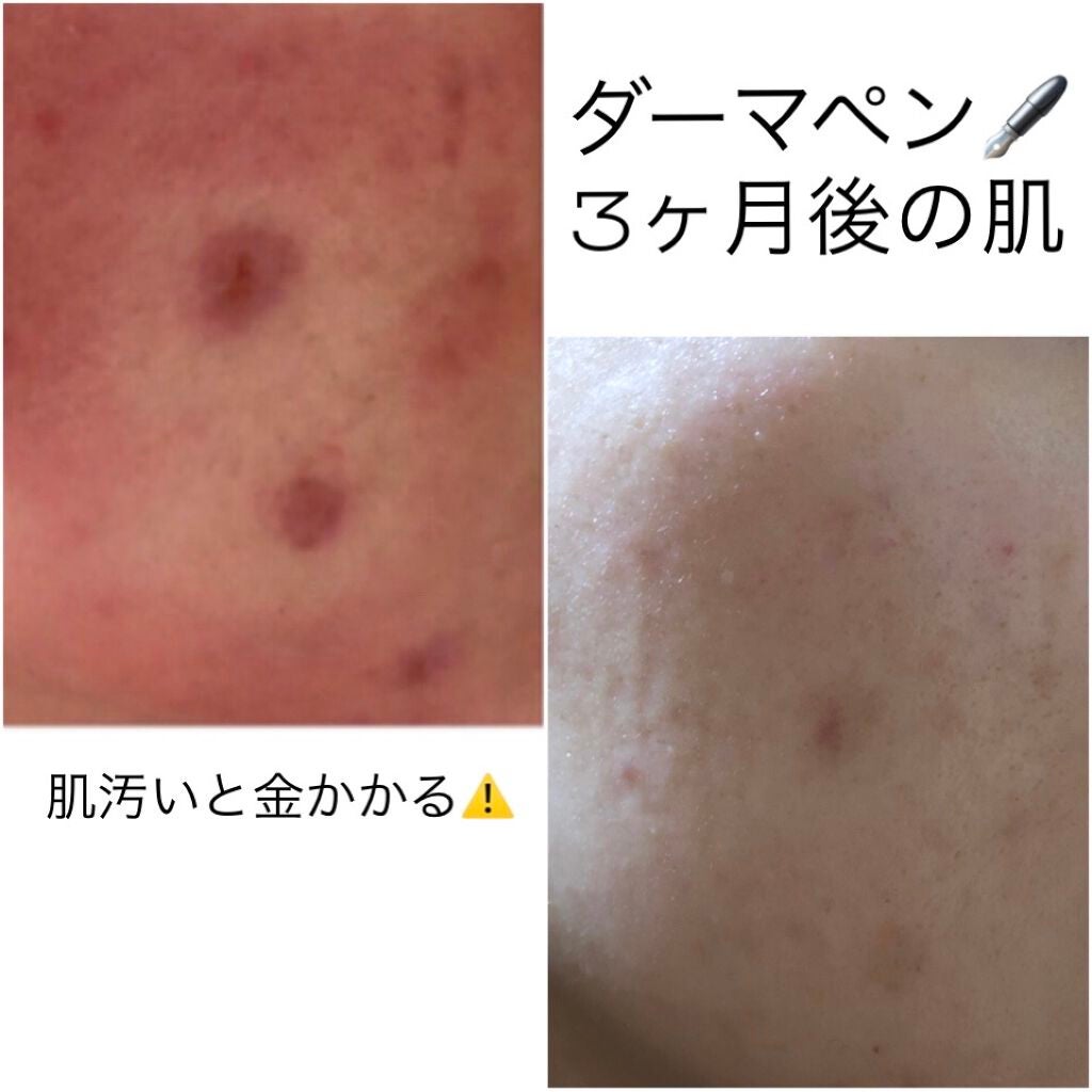 ビタミンB MIX/Dear-Natura (ディアナチュラ)/健康サプリメントを使ったクチコミ(1枚目)