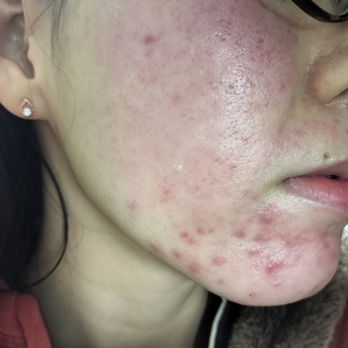 PLACENTREX EXTRACT GEL(ヒトプラセンタジェル)/Placentrex/その他を使ったクチコミ(2枚目)