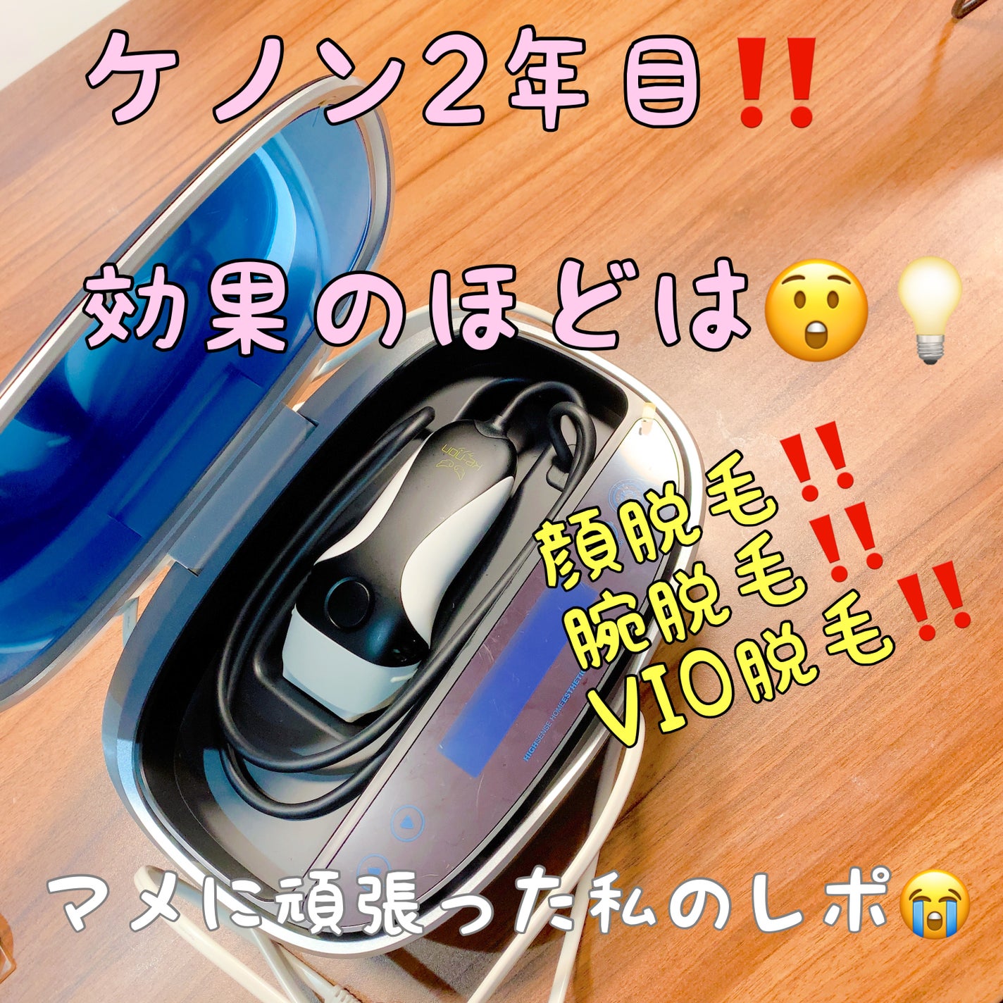 光美容器KE-NON(ケノン) ブラック(つや消し) / エムテック 光美容器KE-NON(ケノン) ブラック(つや消し) / エムテック
