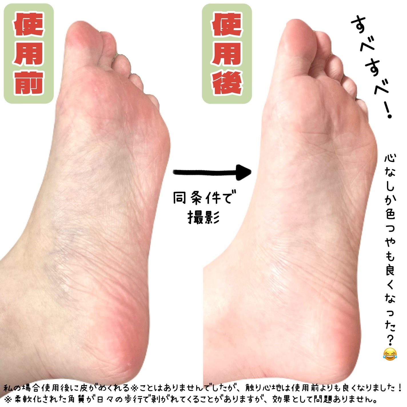 イージーパックDP60分タイプ/ベビーフット/レッグ・フットケアを使ったクチコミ(5枚目)