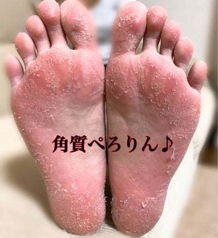 bea's up フットピーリングパック ペロリン グレープフルーツ/素数/レッグ・フットケアを使ったクチコミ(2枚目)