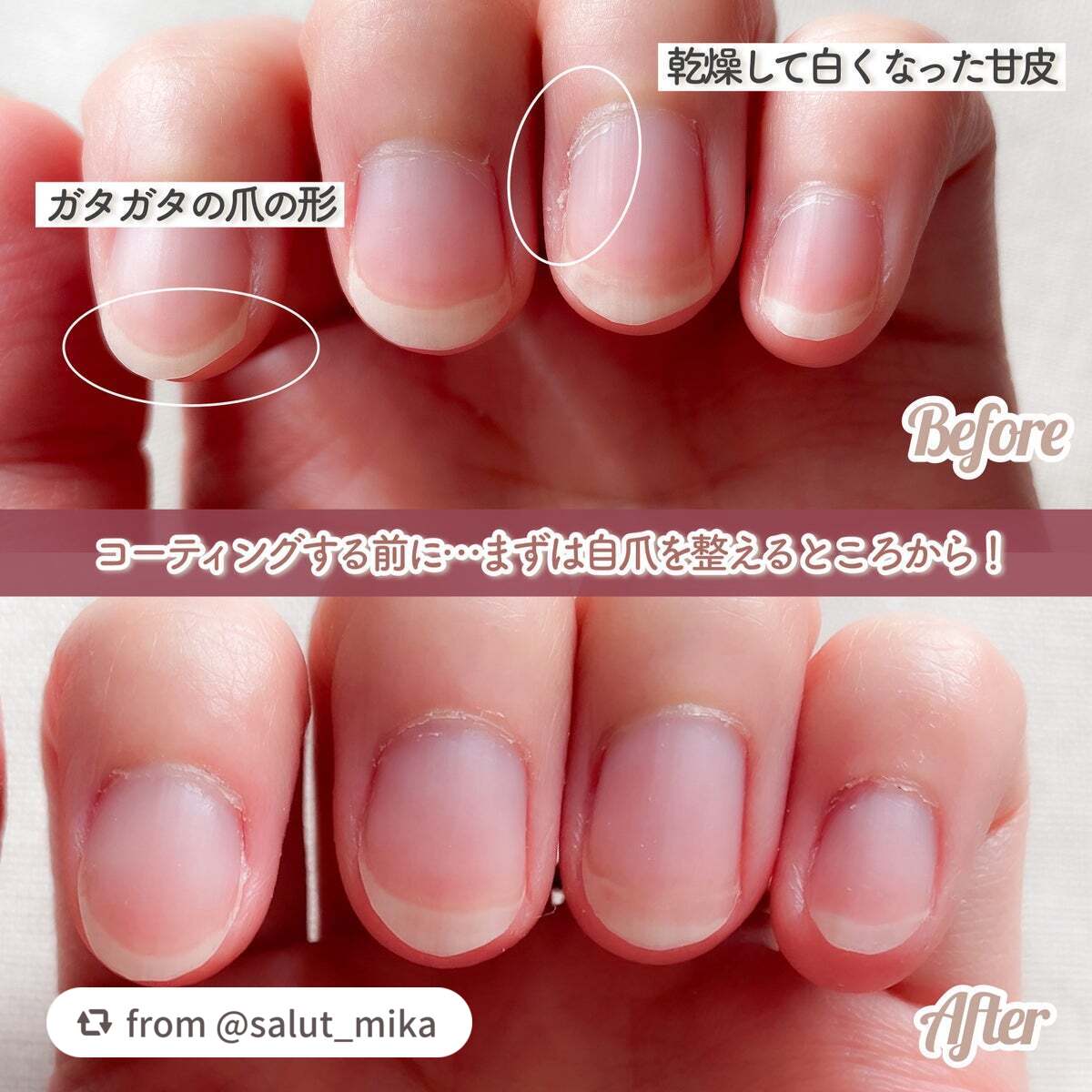 ストロングガード/D-UP/ネイル・ネイルケアを使ったクチコミ(2枚目)