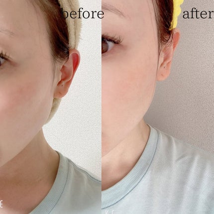 美白乃美人 ホワイトニングピーリングジェル/ブレーンコスモス/ピーリングを使ったクチコミ(2枚目)