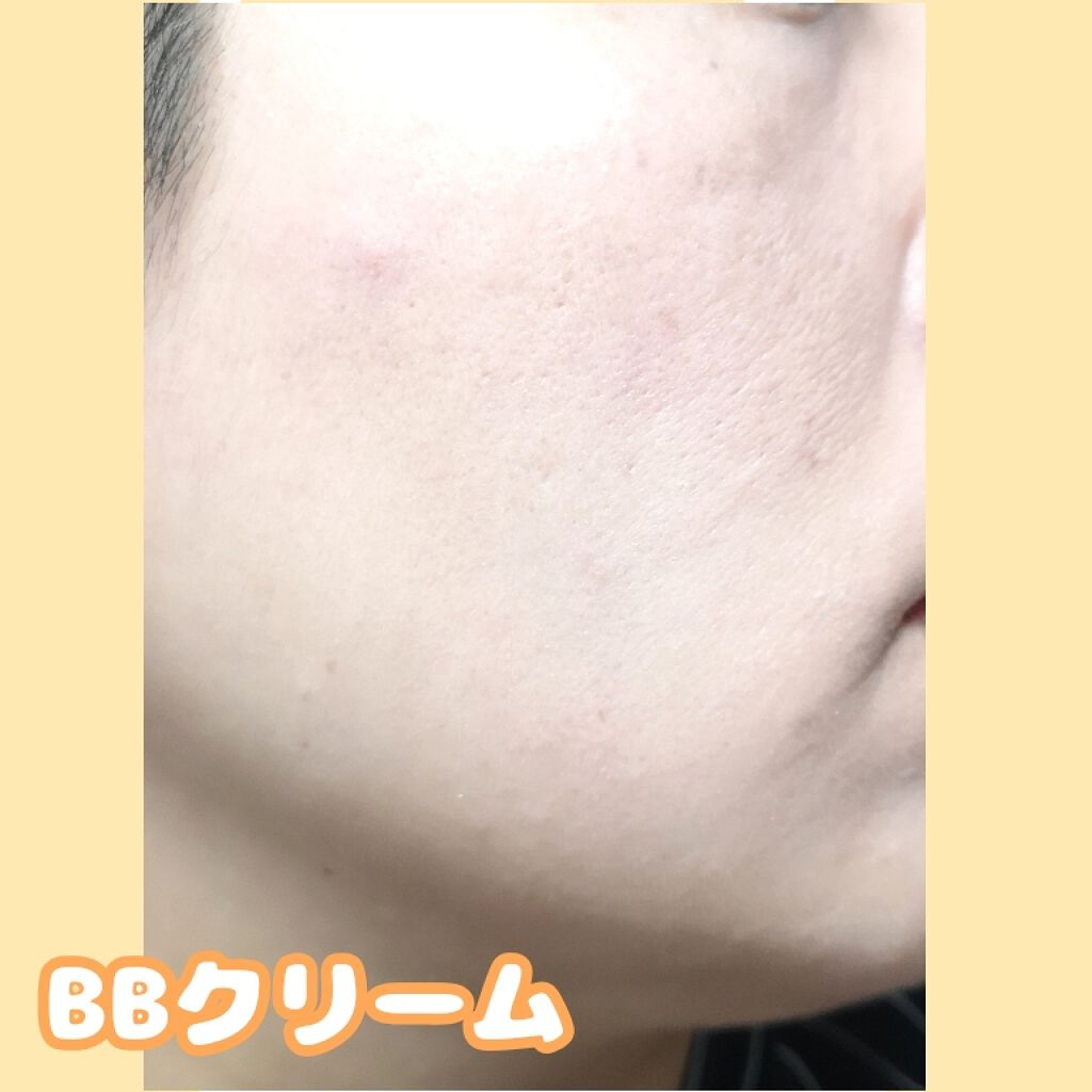 アレルバリア エッセンス BB/d プログラム/BBクリームを使ったクチコミ（3枚目）