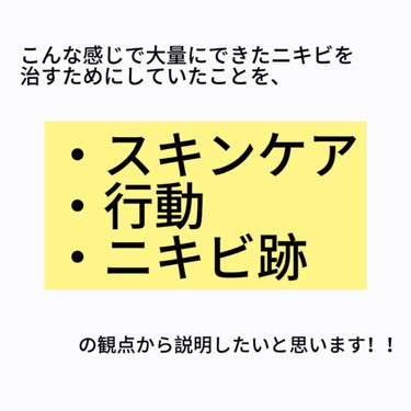 薬用ふわふわな泡洗顔/メンソレータム アクネス/泡洗顔を使ったクチコミ（4枚目）