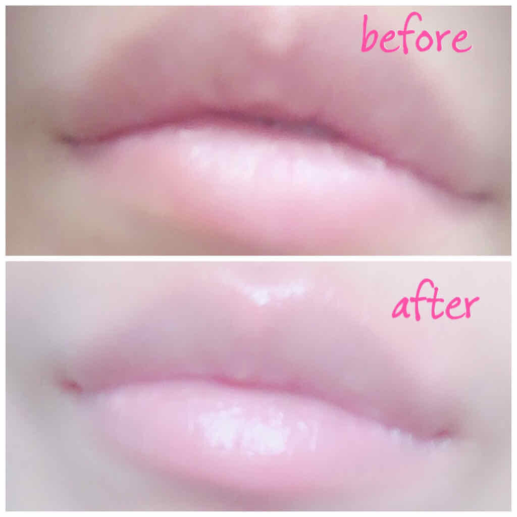 イヴズ フルーツ/ラッシュ/リップケアを使ったクチコミ（2枚目）