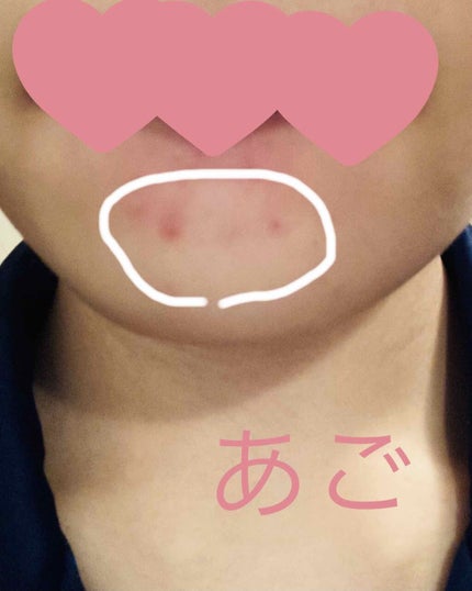 セラコラ しっとり化粧水/セラコラ/化粧水を使ったクチコミ(3枚目)