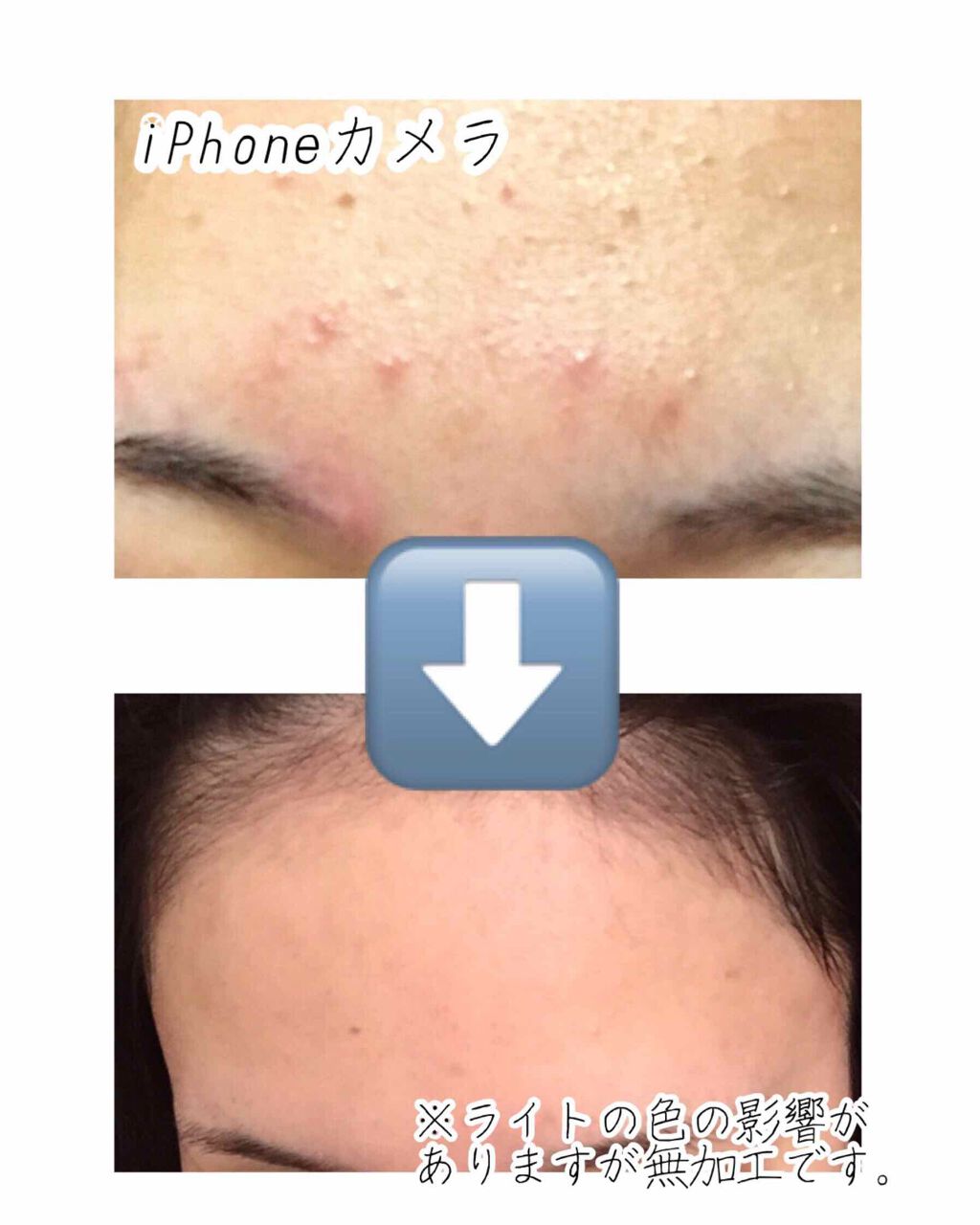 ヒアルロン酸原液/太陽のアロエ社/美容液を使ったクチコミ（2枚目）