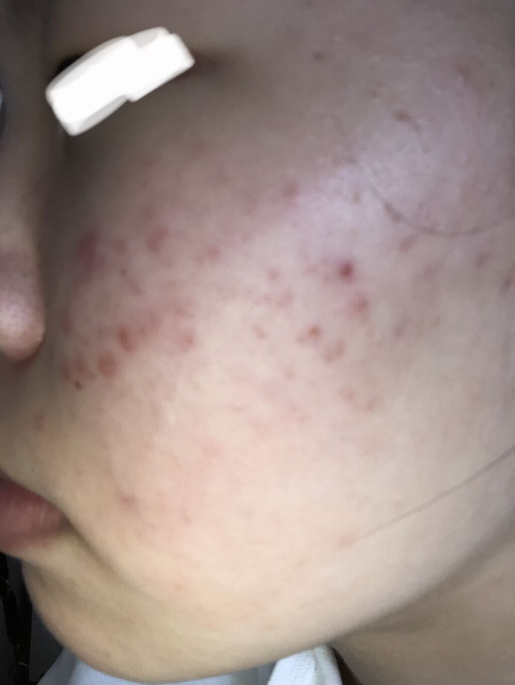 ビタミンC 60粒/Dear-Natura (ディアナチュラ)/健康サプリメントを使ったクチコミ（3枚目）