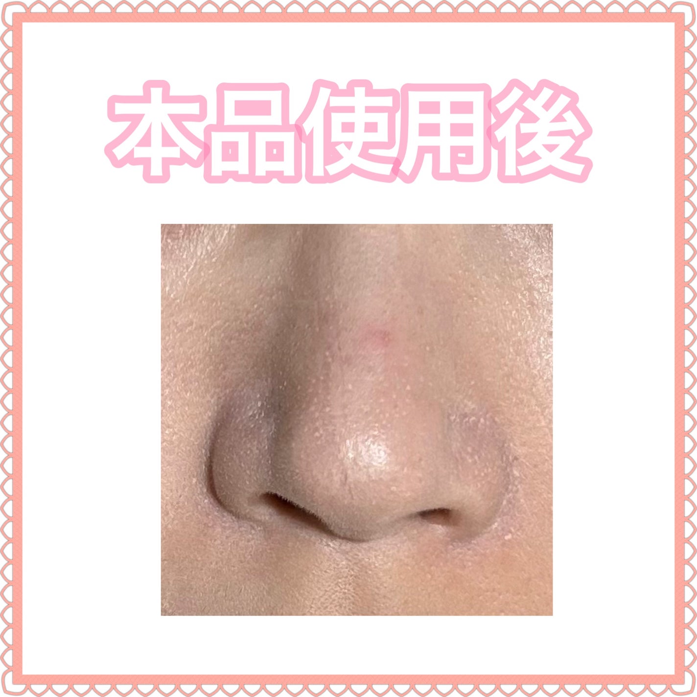 タンイドル ウルトラ ウェア ケア アンド グロウ/LANCOME/リキッドファンデーションを使ったクチコミ(4枚目)