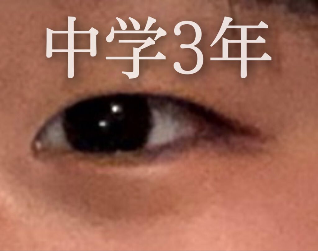 アイトーク クリアジェル/アイトーク/二重まぶた用アイテムを使ったクチコミ（2枚目）