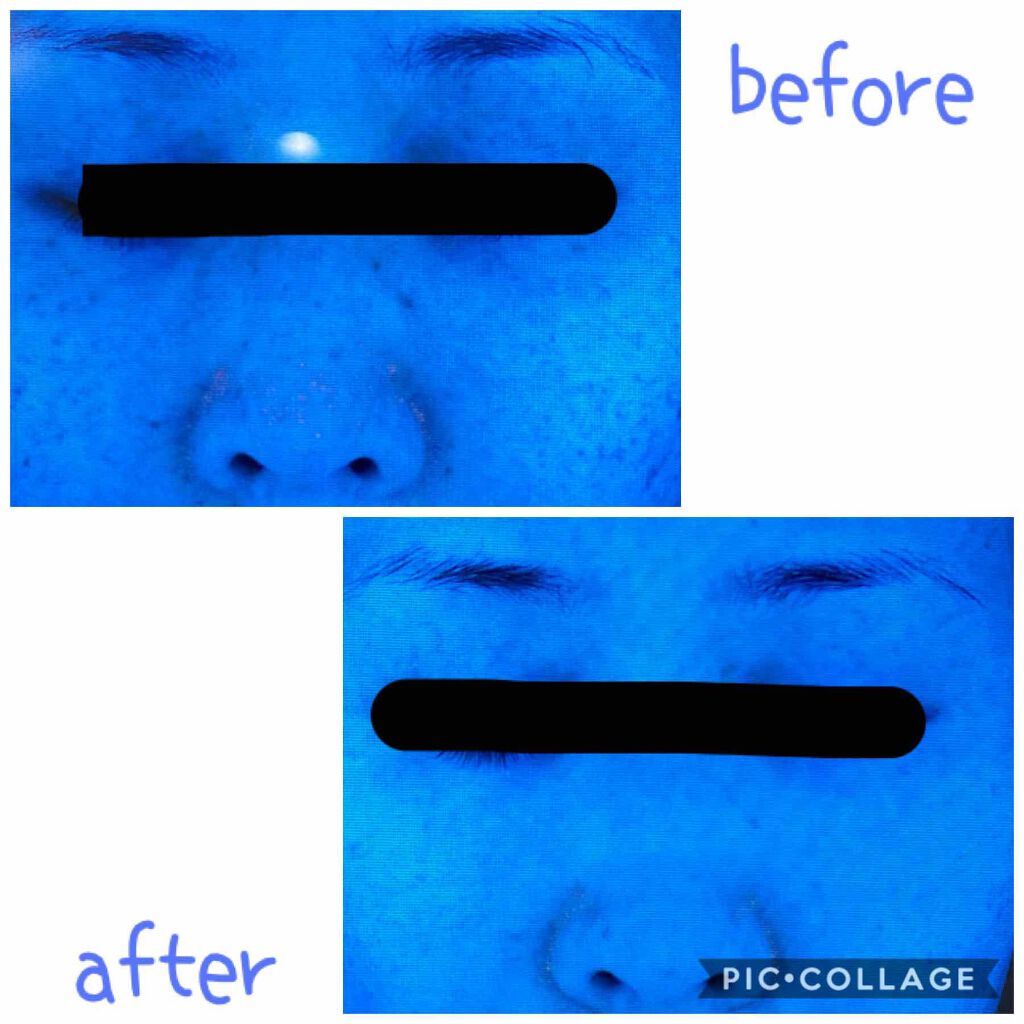 ミラミックス/ZO Skin Health/フェイスクリームを使ったクチコミ（2枚目）