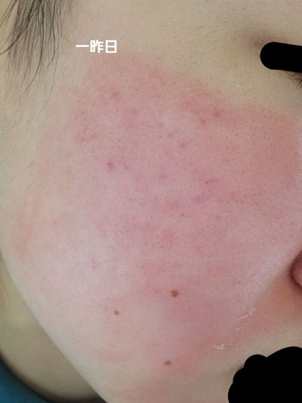 ハトムギ化粧水(ナチュリエ スキンコンディショナー R )/ナチュリエ/化粧水を使ったクチコミ(3枚目)