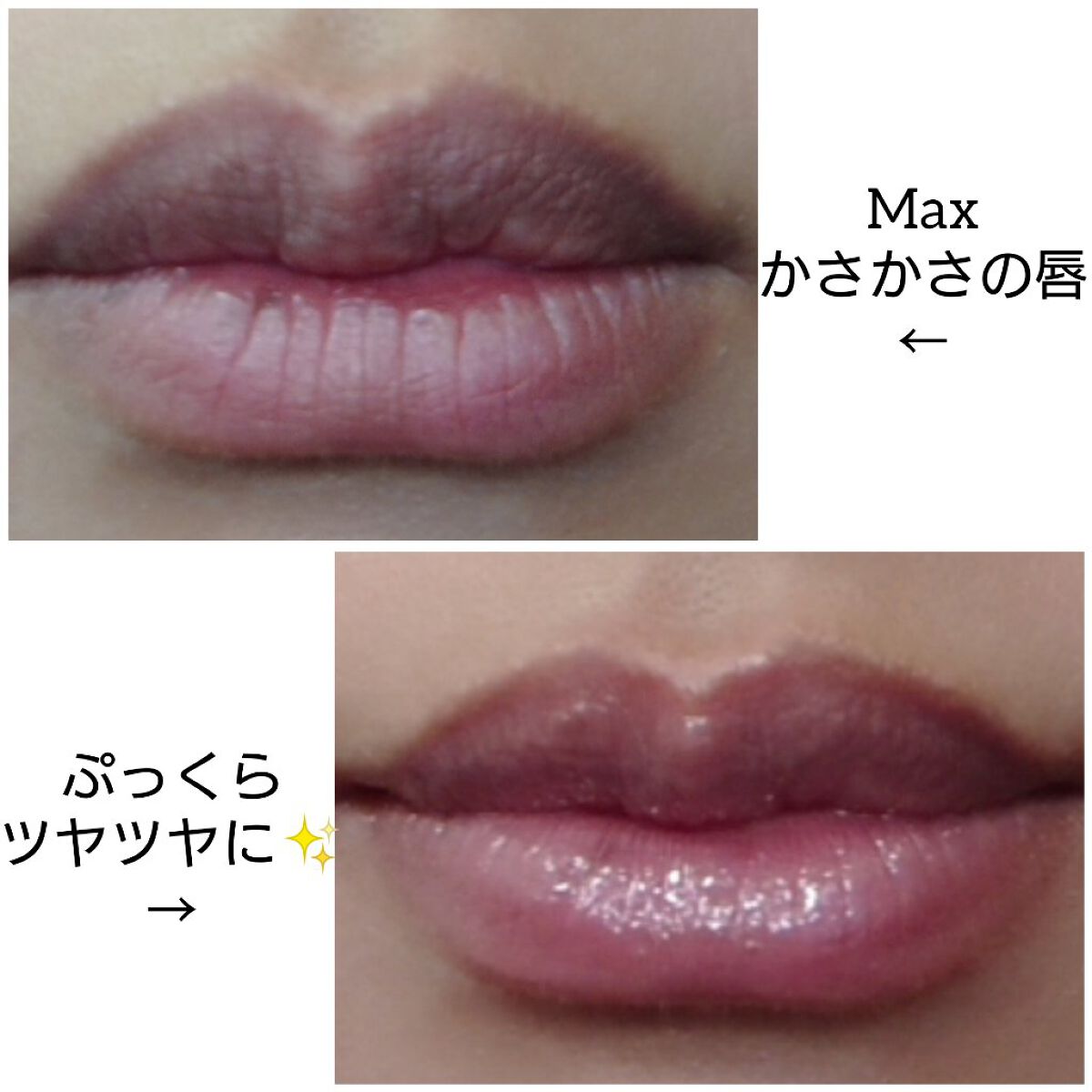 リッププランパー/otona couture/リッププランパーを使ったクチコミ(3枚目)