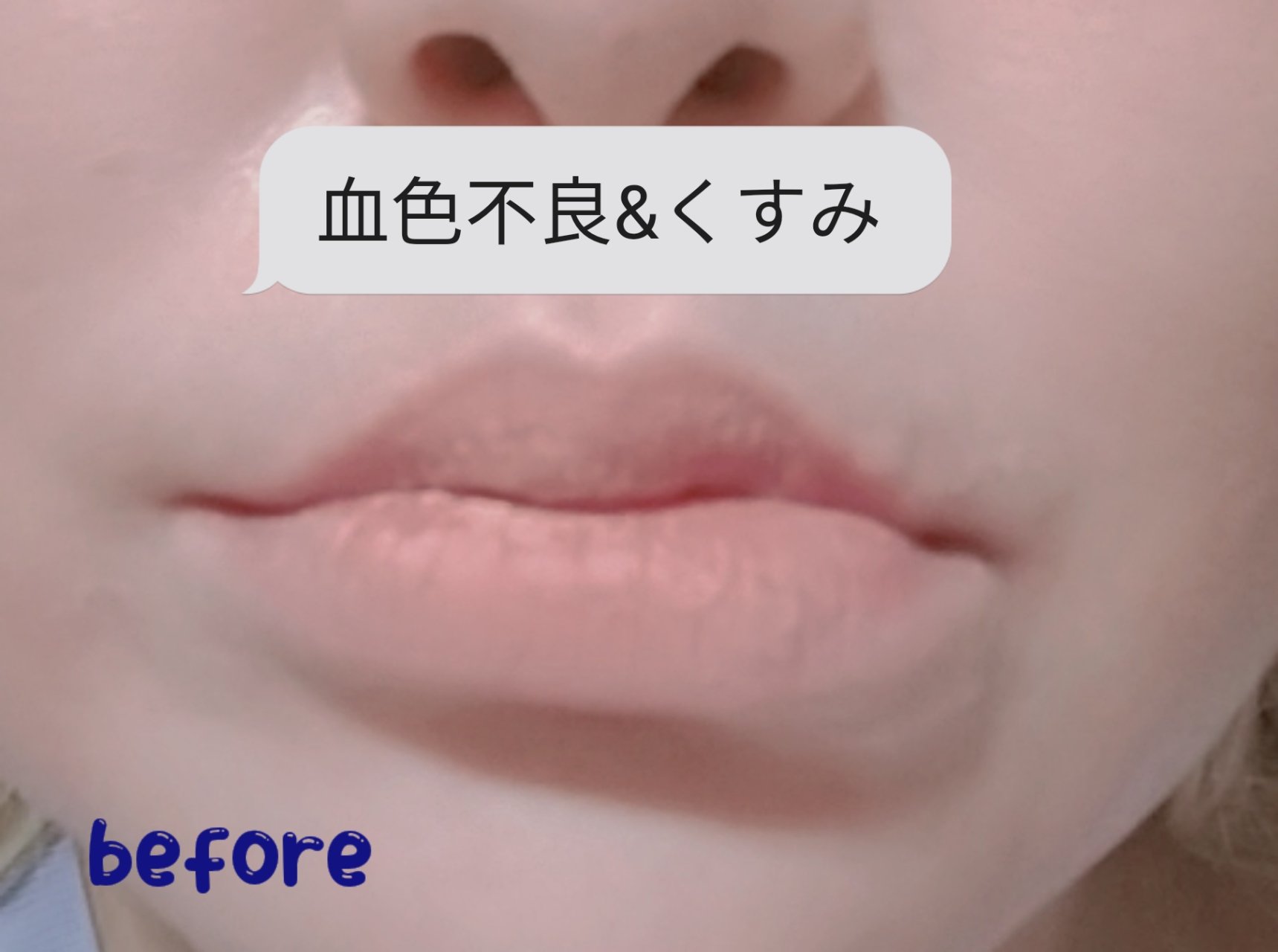 モイストリップ(バニラの香り)/ユリアージュ/リップクリームを使ったクチコミ（1枚目）