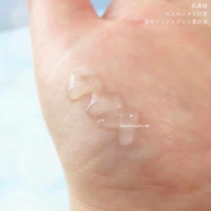 大人のニキビ対策 薬用クリアスポッツ美容液 /肌美精/美容液を使ったクチコミ(3枚目)