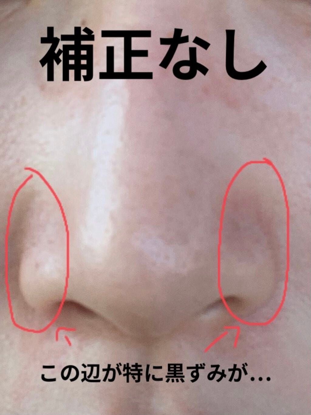 ゼロ毛穴1DAYセラム/MEDICUBE/美容液を使ったクチコミ(3枚目)