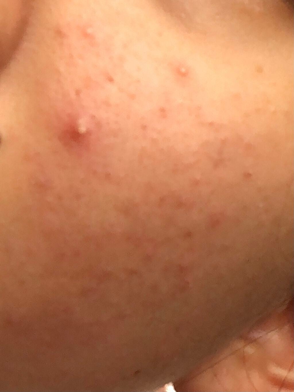 薬用しみ対策 美白化粧水 しっとりタイプ/メラノCC/化粧水を使ったクチコミ(2枚目)