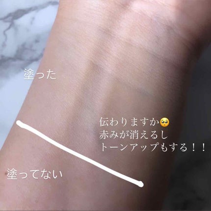 ドクタージャルト シカペア リカバー (第2世代)/Dr.Jart+/フェイスクリームを使ったクチコミ(2枚目)