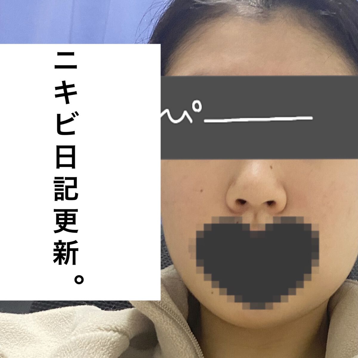 潤浸保湿 乳液/キュレル/乳液を使ったクチコミ（1枚目）