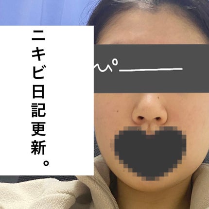 æœ€æµžä¿æ¹¿ 乳液/ãã¥ã¬ã«/乳液ã䜿ã£ãã¯ãã³ãïŒ1æç®ïŒ