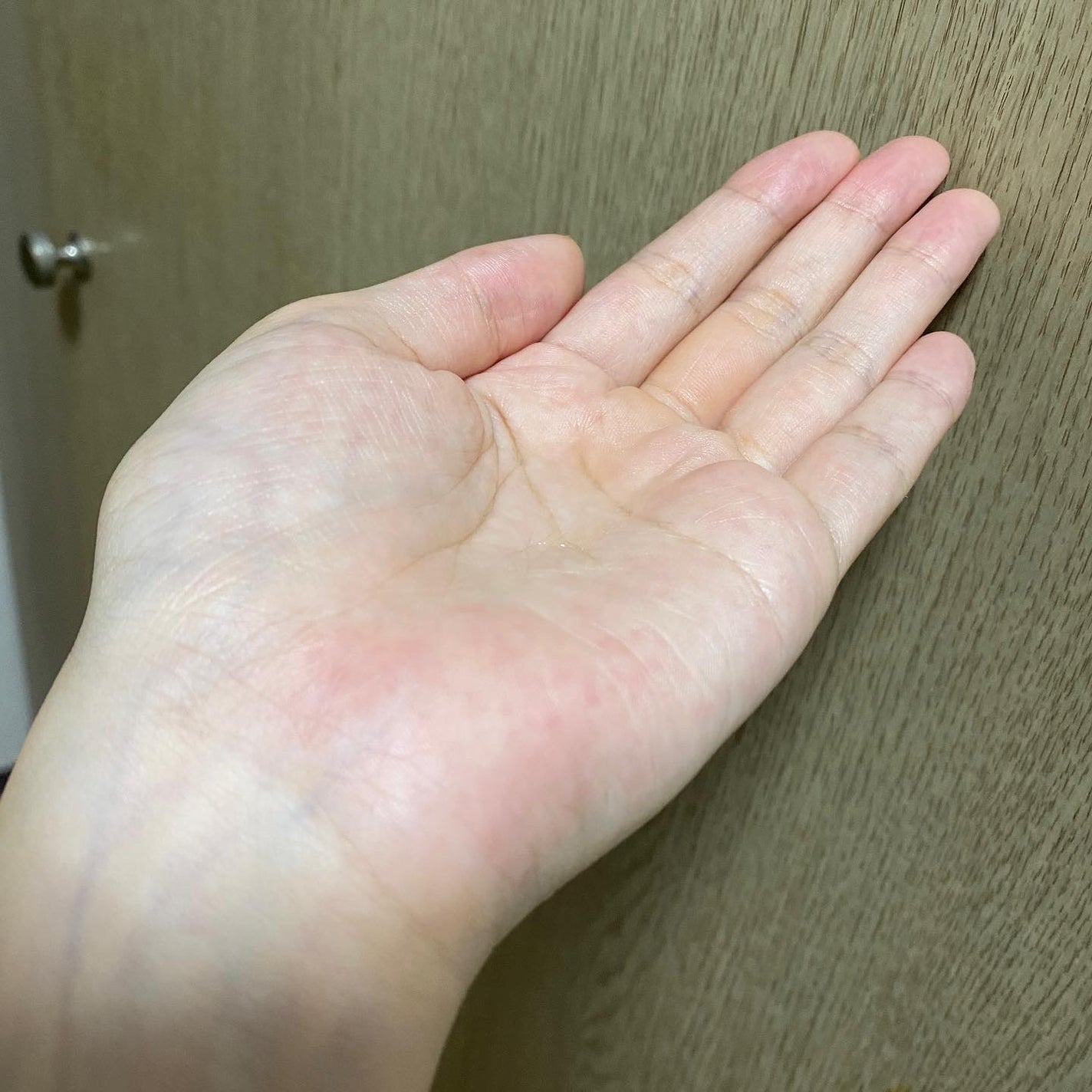 ドクダミ 77 スージングトナー/Anua/化粧水を使ったクチコミ(5枚目)