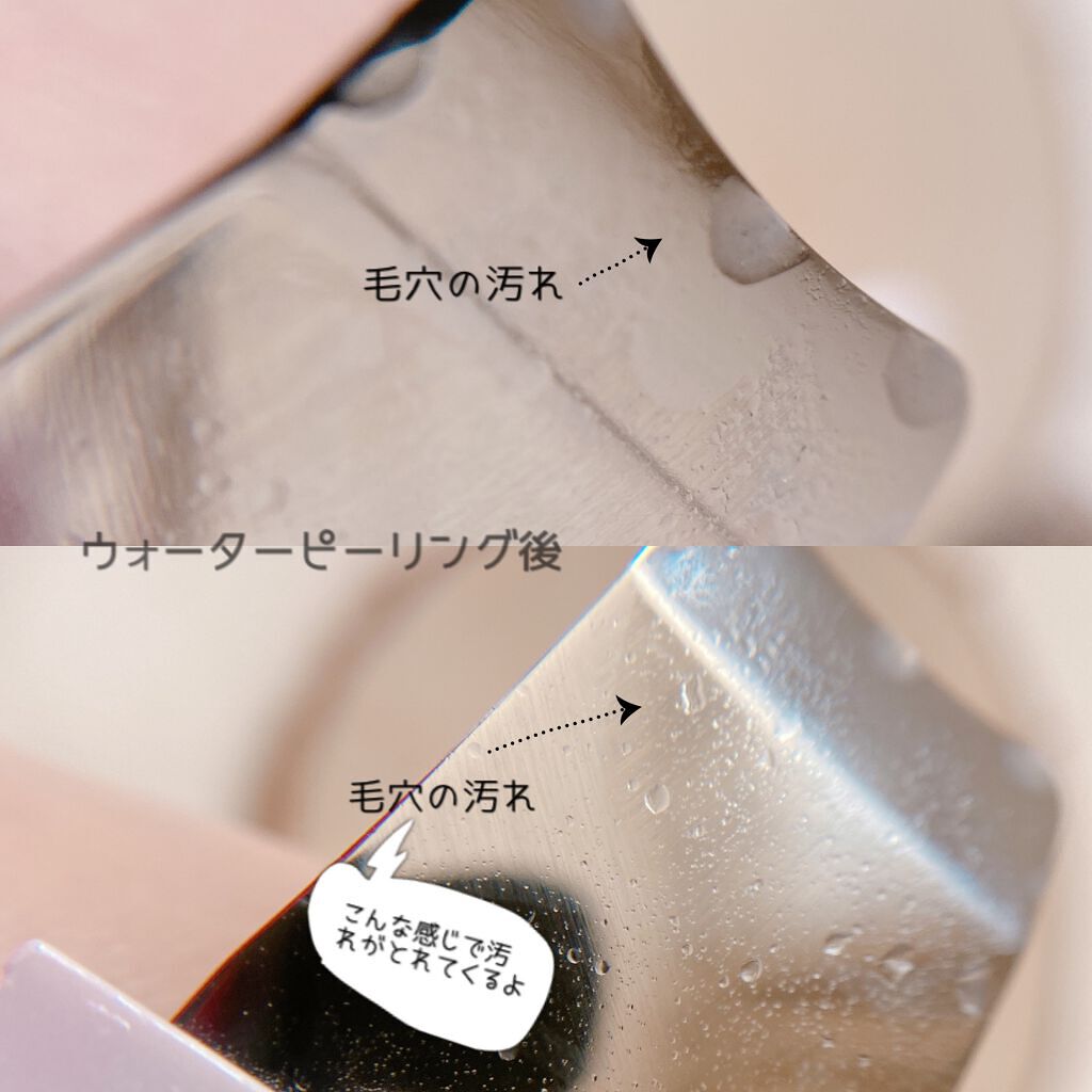 モイスチャーピーリングプロ/Le ment/美顔器・マッサージを使ったクチコミ(5枚目)