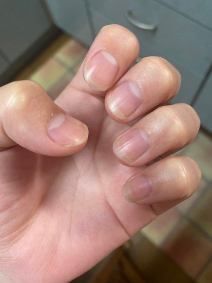 ウィンマックス キューティクルオイル/DAISO/ネイルオイル・トリートメントを使ったクチコミ(1枚目)