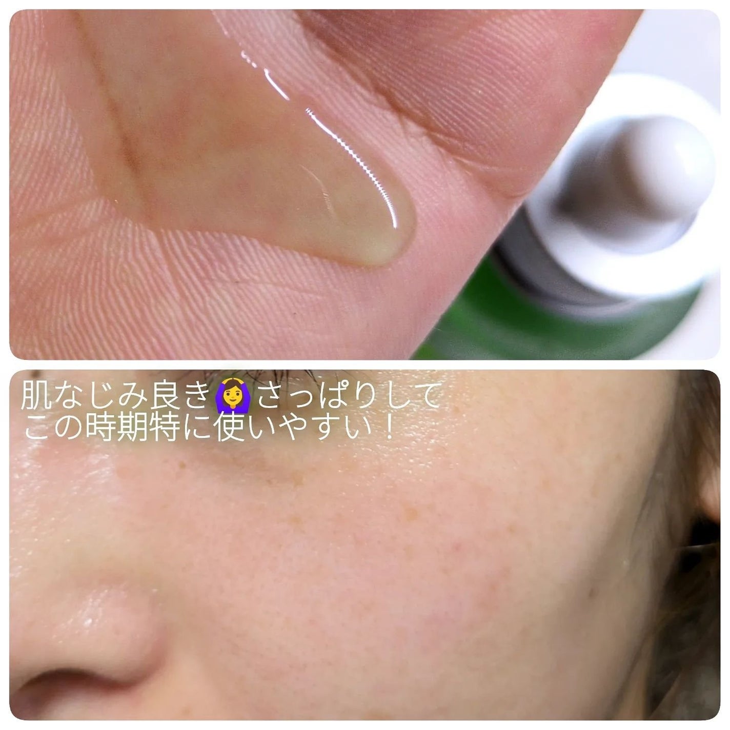 アゼライン酸15 インテンスカーミングセラム/Anua/美容液を使ったクチコミ(5枚目)