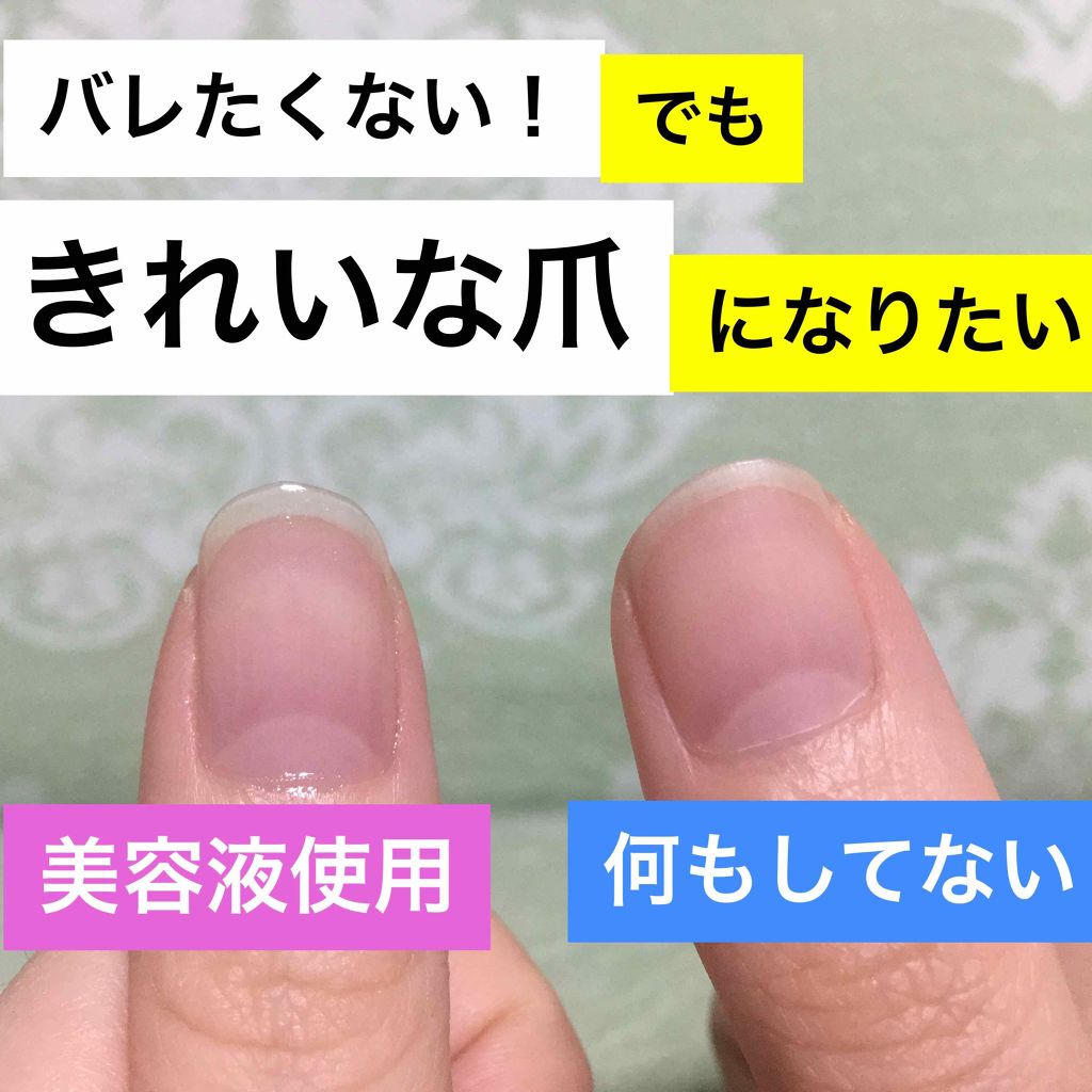 エテュセ クイックケアコート/ettusais/ネイルオイル・トリートメントを使ったクチコミ(1枚目)