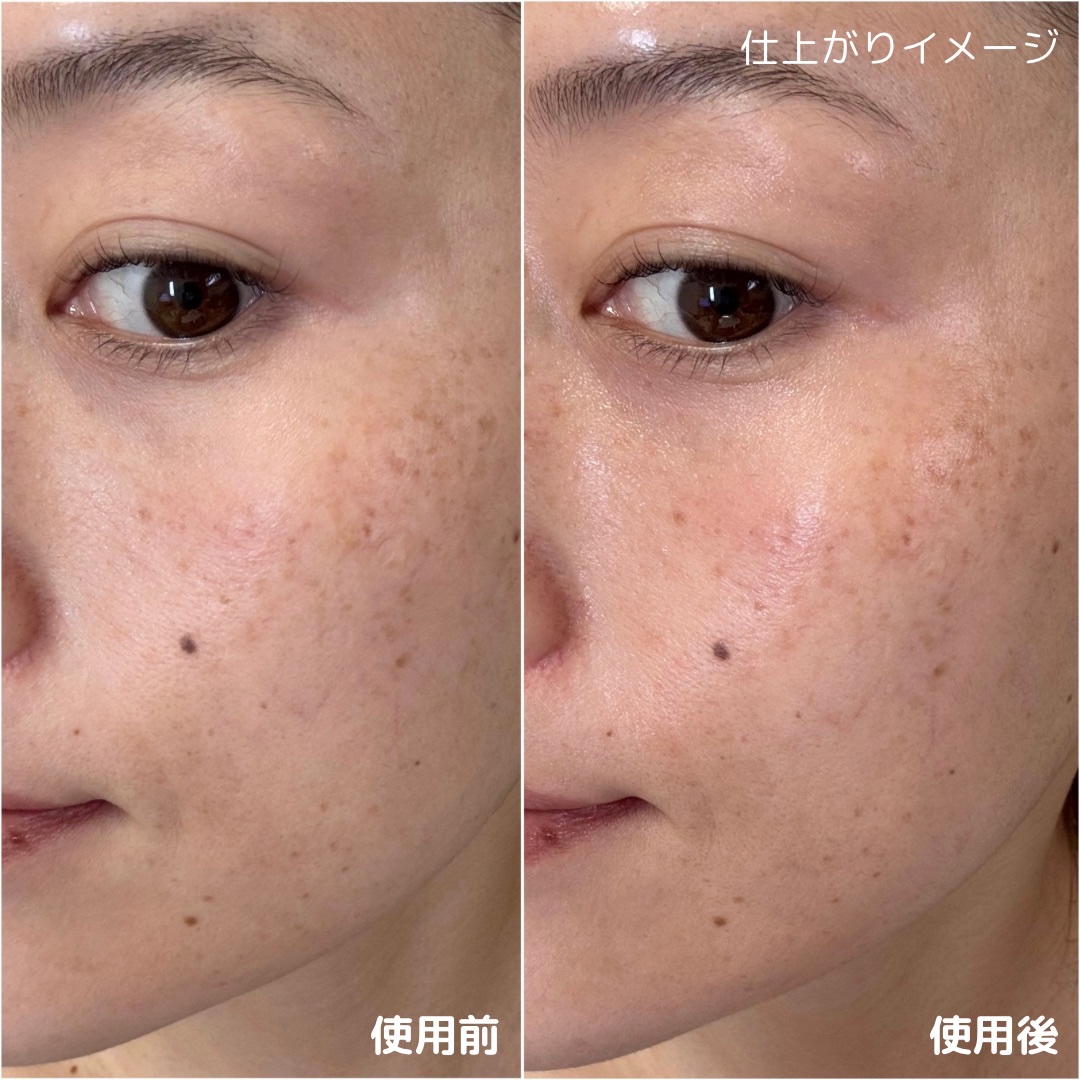 RXザ・アルファアルブチン2 ニキビ跡ケアセラム/COSRX/美容液を使ったクチコミ（3枚目）