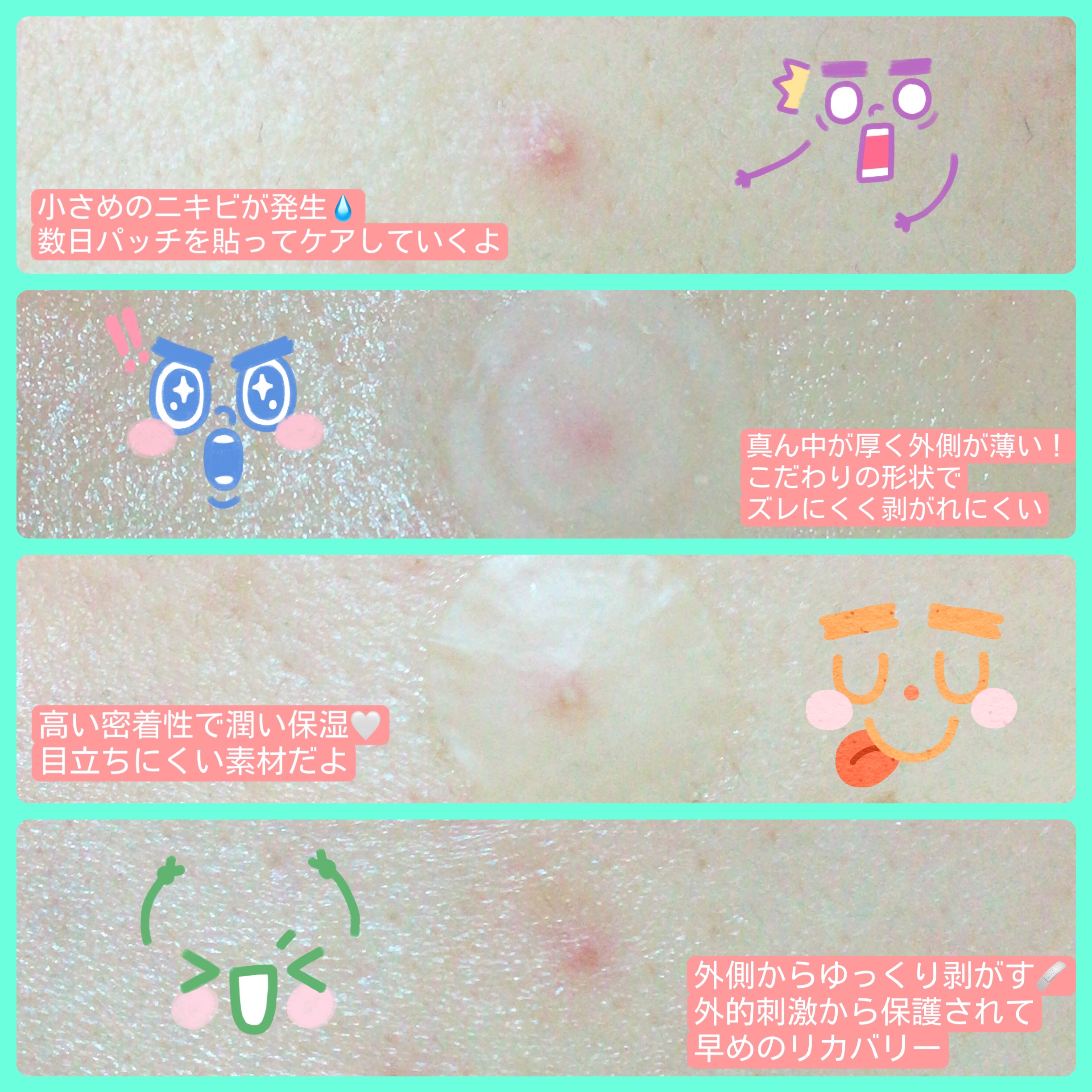 プロアクティブ スキンケアパッチ/プロアクティブ/にきびパッチを使ったクチコミ（2枚目）