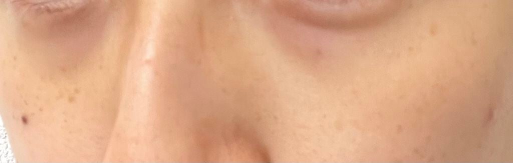 【旧】ディオールスキン フォーエヴァー スキン コレクト コンシーラー/Dior/リキッドコンシーラーを使ったクチコミ(5枚目)