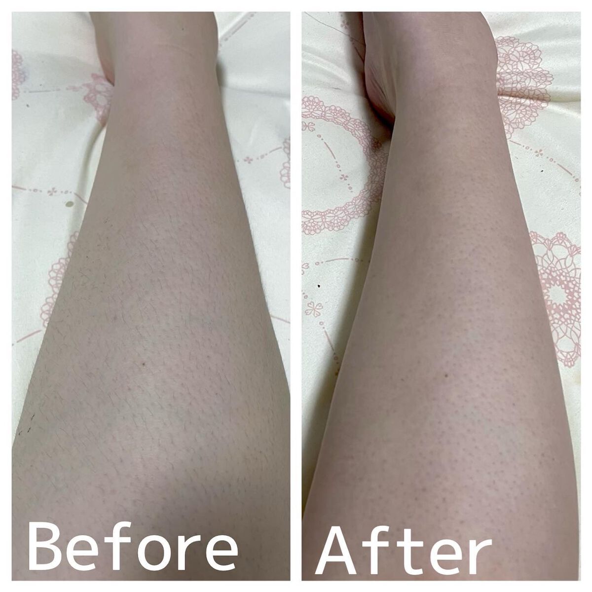 ミュゼコスメ メンズ 薬用ヘアリムーバルクリーム ホワイトシトラスの香り/ミュゼコスメ/除毛クリームを使ったクチコミ(6枚目)