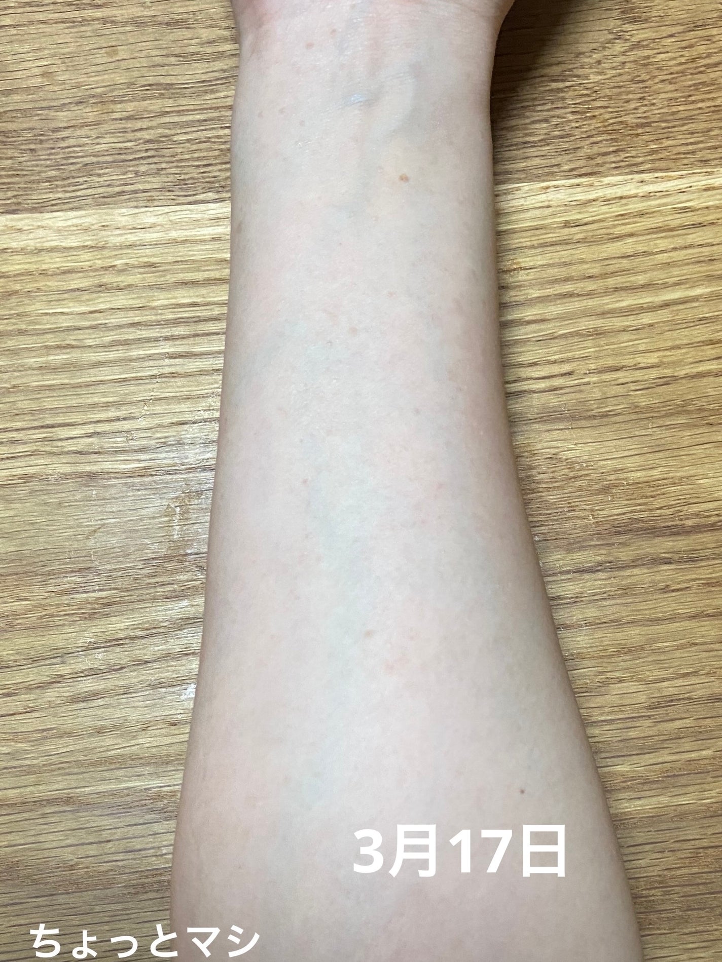 リードルショット100/VT/美容液を使ったクチコミ(2枚目)