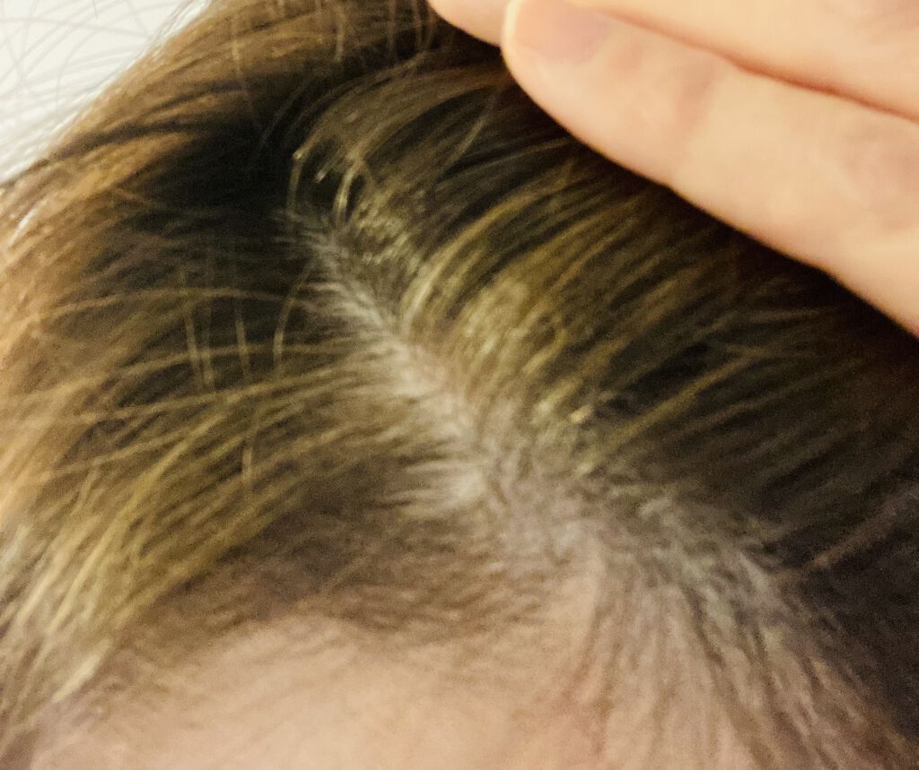 カラートリートメント/サイオス/ヘアカラーを使ったクチコミ（2枚目）